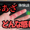 【生まれつき赤痣】痛い感覚？熱い感覚？などの質問への最適解と気まずくならない初対面での向き合い方